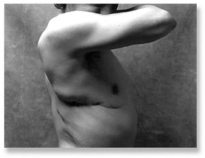Cicatrices, de Ernesto Reich