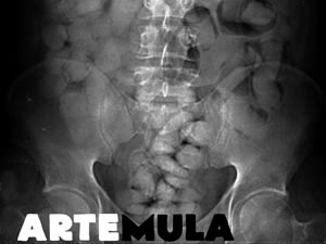 ArteMula: El arte como placer subversivo.